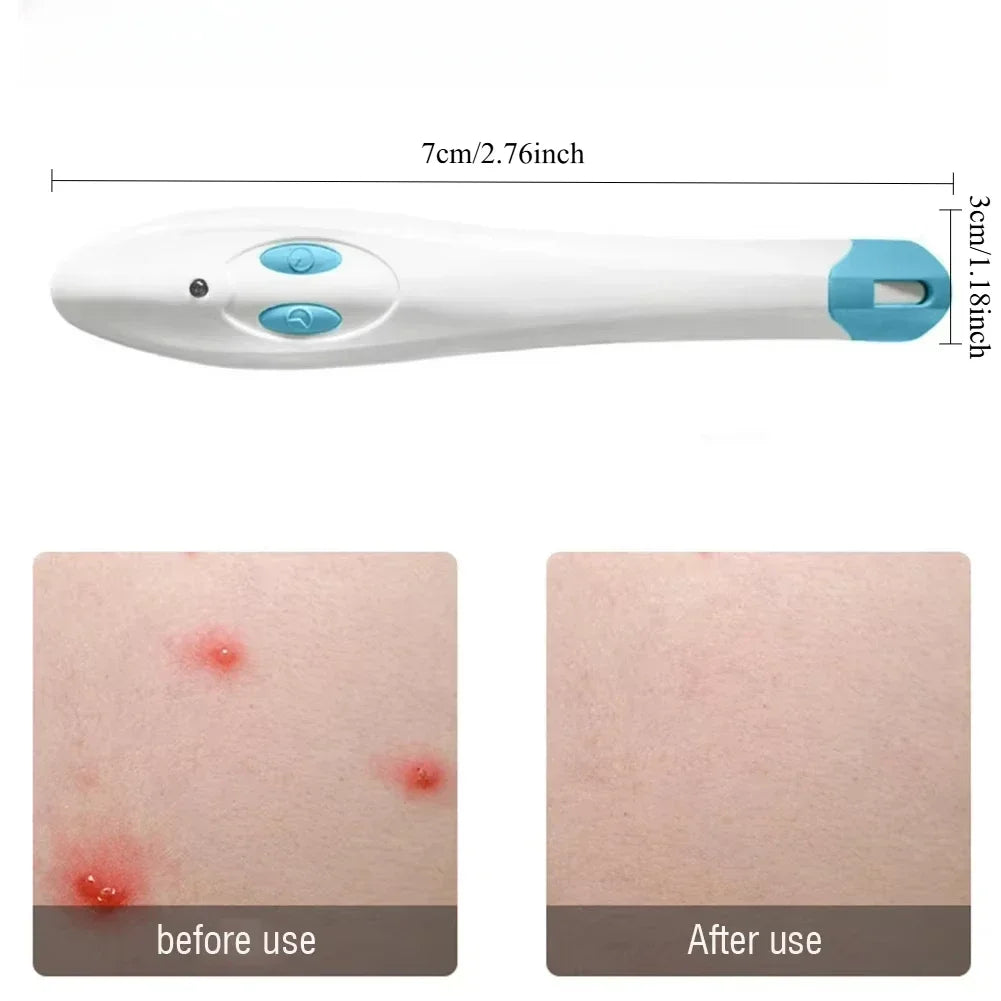 Portable Antipruritic Device for Effective Relief from Insect Stings and Bites, Ideal for Outdoor and Household Use