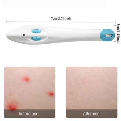 Portable Antipruritic Device for Effective Relief from Insect Stings and Bites, Ideal for Outdoor and Household Use